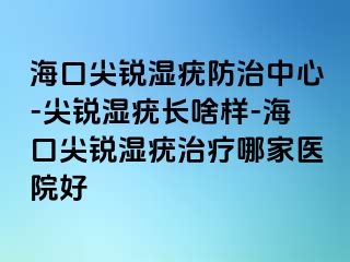 海口尖锐湿疣防治中心-尖锐湿疣长啥样-海口尖锐湿疣治疗哪家医院好