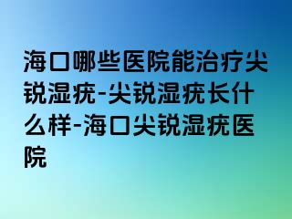 海口哪些医院能治疗尖锐湿疣-尖锐湿疣长什么样-海口尖锐湿疣医院