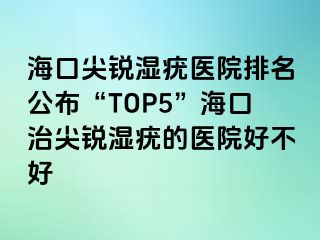 海口尖锐湿疣医院排名公布“TOP5”海口治尖锐湿疣的医院好不好