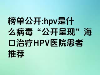 榜单公开:hpv是什么病毒“公开呈现”海口治疗HPV医院患者推荐