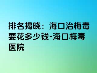 排名揭晓：海口治梅毒要花多少钱-海口梅毒医院